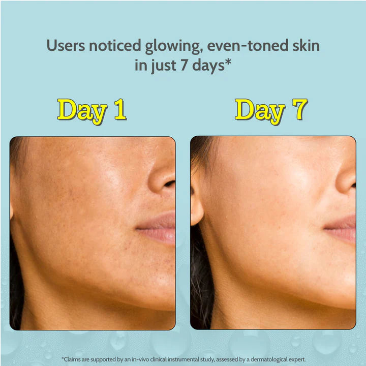 10% Vitamin C Serum with 2% Glucosamine for Glowing Skin - 10 ml